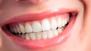 Uso del ácido hialurónico en odontología