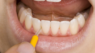 ¿Sabes cómo usar el cepillo interdental?